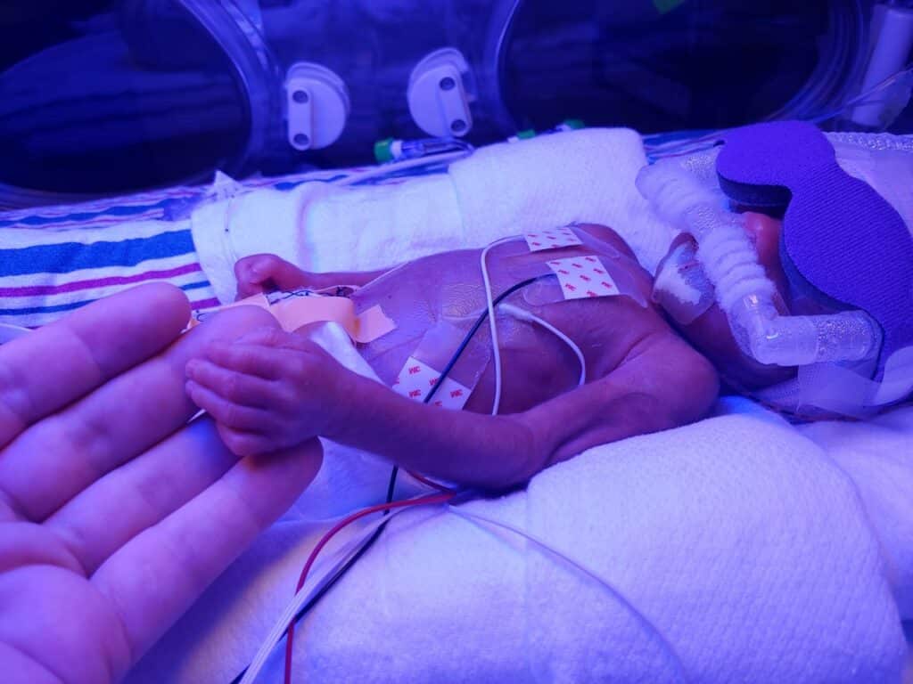 Baby Henry In The NICU
