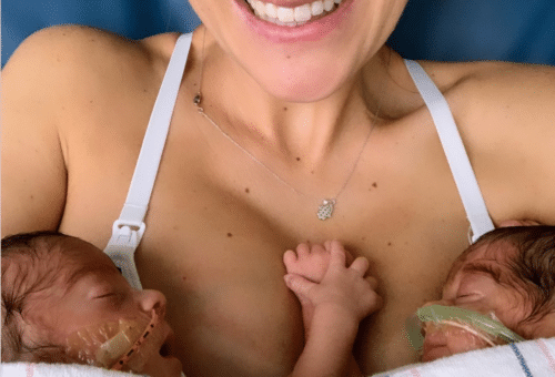 An unexpected delivery and a happy mom holding her premature twins